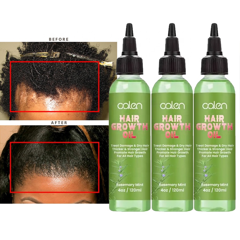 Oalen Hair Care Nourishing Scalp Oil for Enhanced Hair Progress and Pressure Reduction with Refreshing Mint